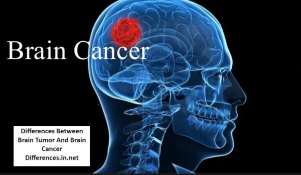 Differences Between Brain Tumor and Brain Cancer